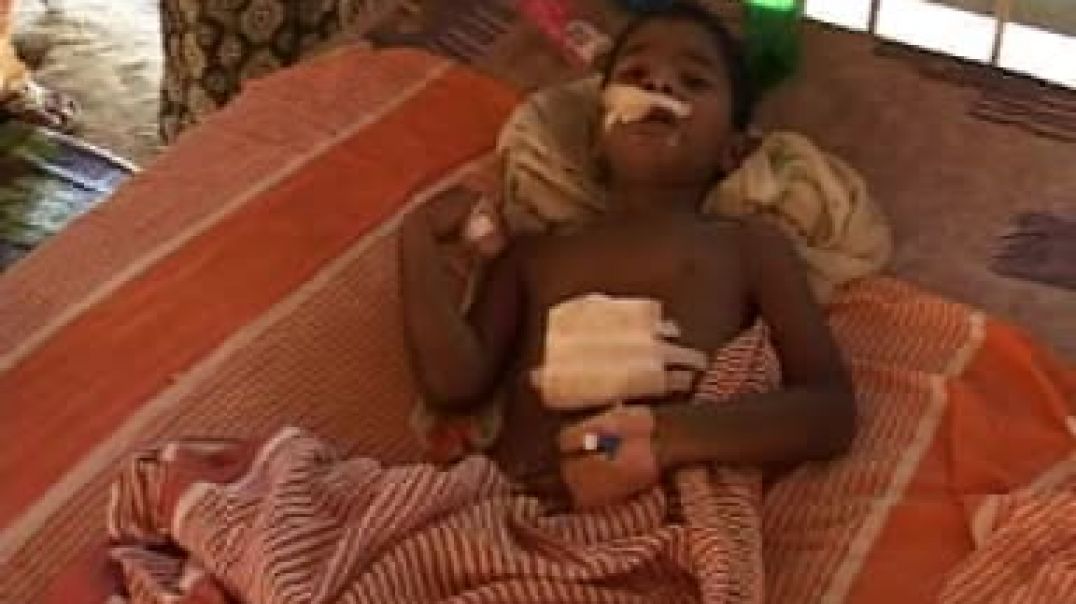 30-1-2009 injured tamil child at hospital ⁣| Tamil genocide | இனப்படுகொலை | முள்ளிவாய்க்கால்
