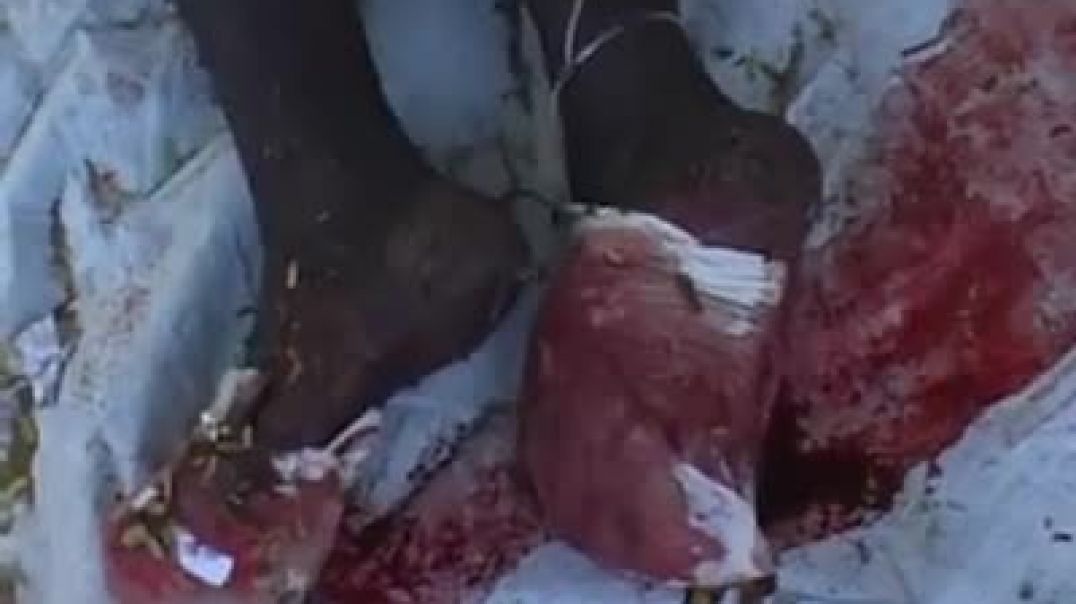 Injured leg of a tamil civilian | இனப்படுகொலை | Tamil genocide | mullivaikkal | முள்ளிவாய்க்கால்