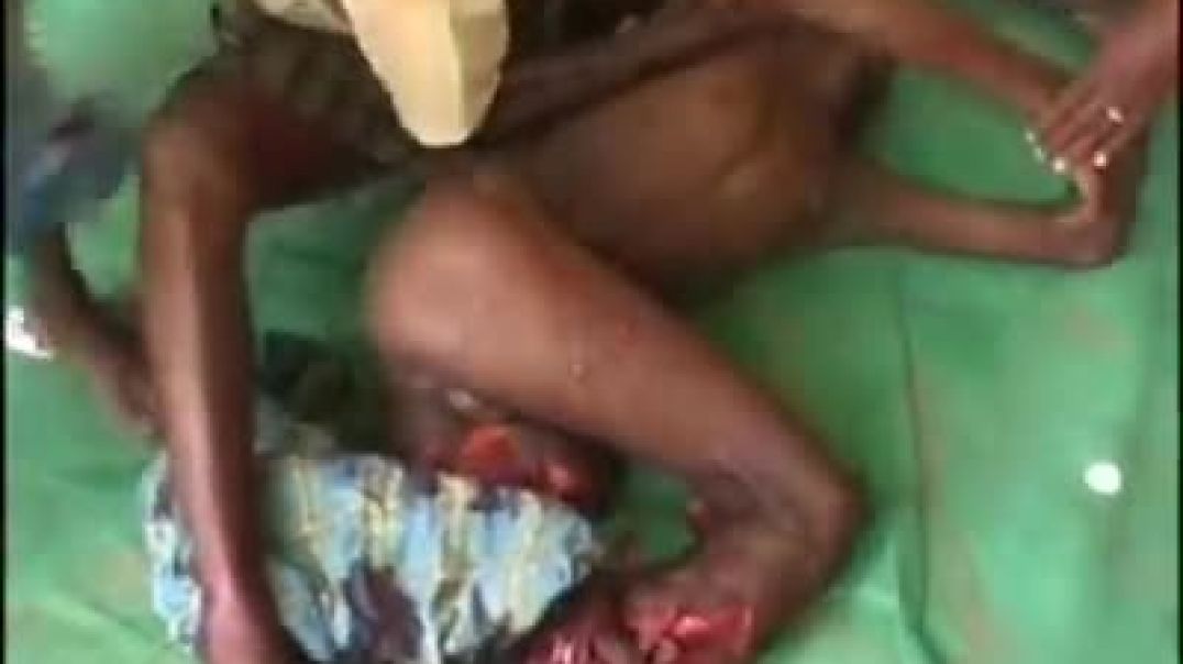 26-3-2009 | இனப்படுகொலை | Tamil genocide | mullivaikkal | முள்ளிவாய்க்கால்